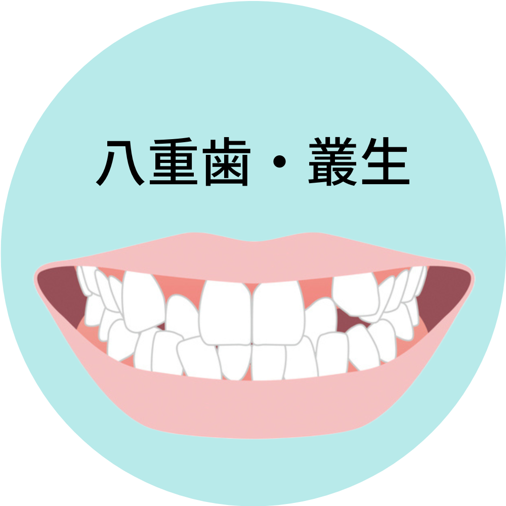 沖縄県那覇市で人気の安いおすすめの八重歯・叢生の歯列矯正