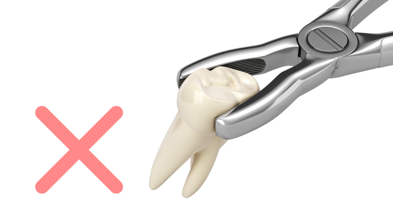 抜歯しない小児矯正 - 沖縄県那覇市 矯正歯科相談室