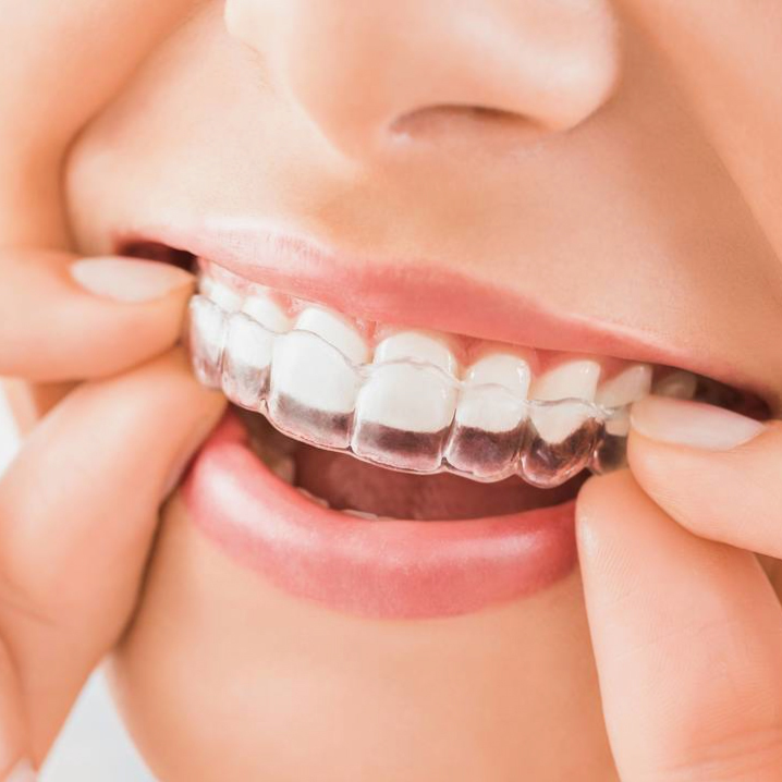 歯列矯正（歯の矯正）の名医と呼ばれるために - 沖縄県那覇市 矯正歯科相談室