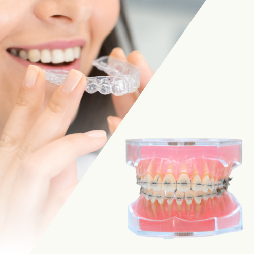 マウスピース矯正は重度の歯並びは適応外 - 沖縄那覇矯正歯科相談室