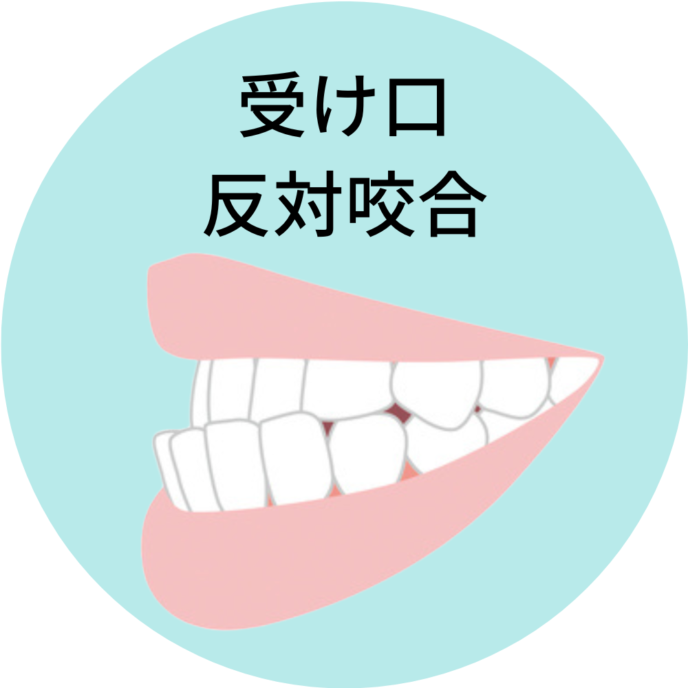 沖縄県那覇市で人気の安いおすすめの受け口・反対咬合・下顎前突の歯列矯正