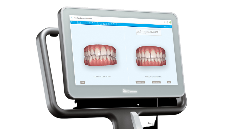 ＡＩに依存しすぎない