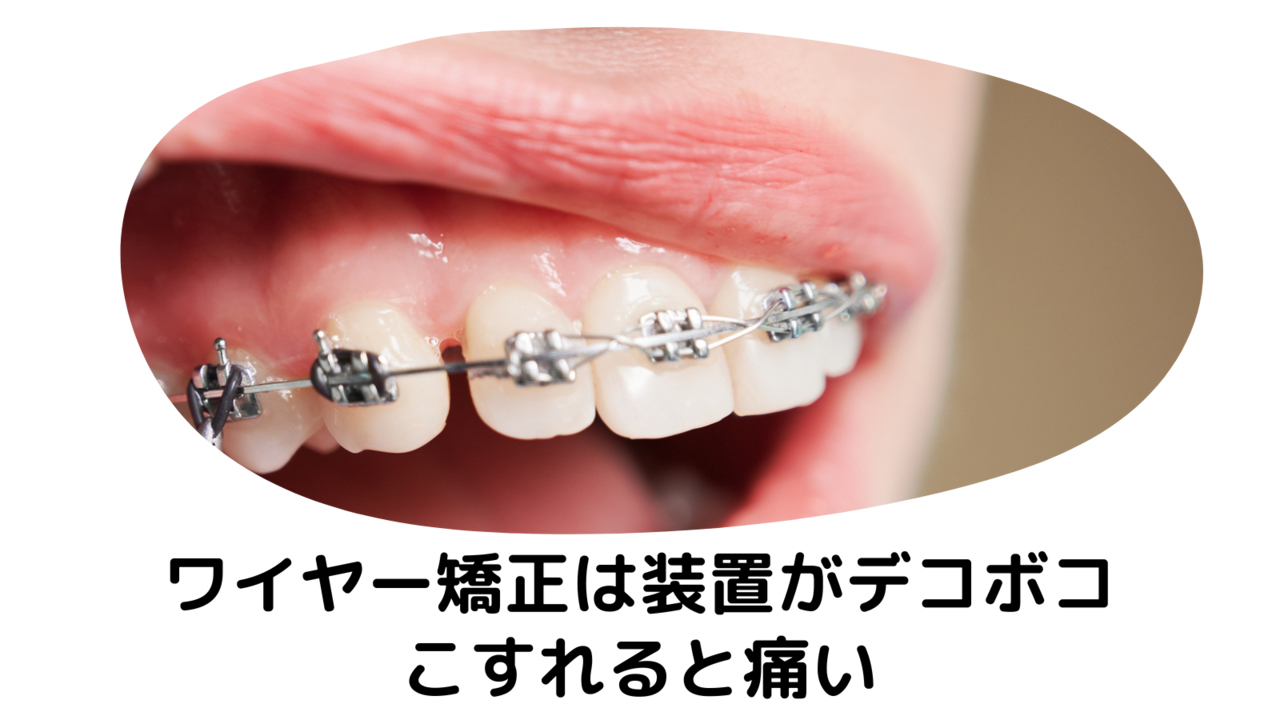 ワイヤー矯正は装置がデコボコ こすれると痛い