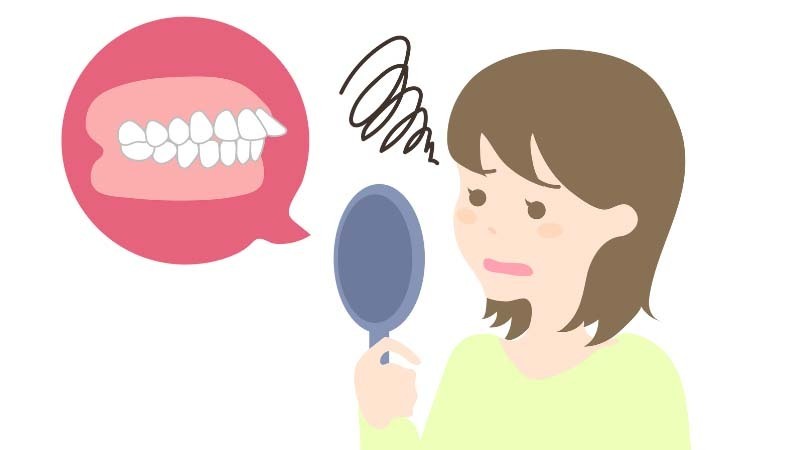 出っ歯に悩む女性